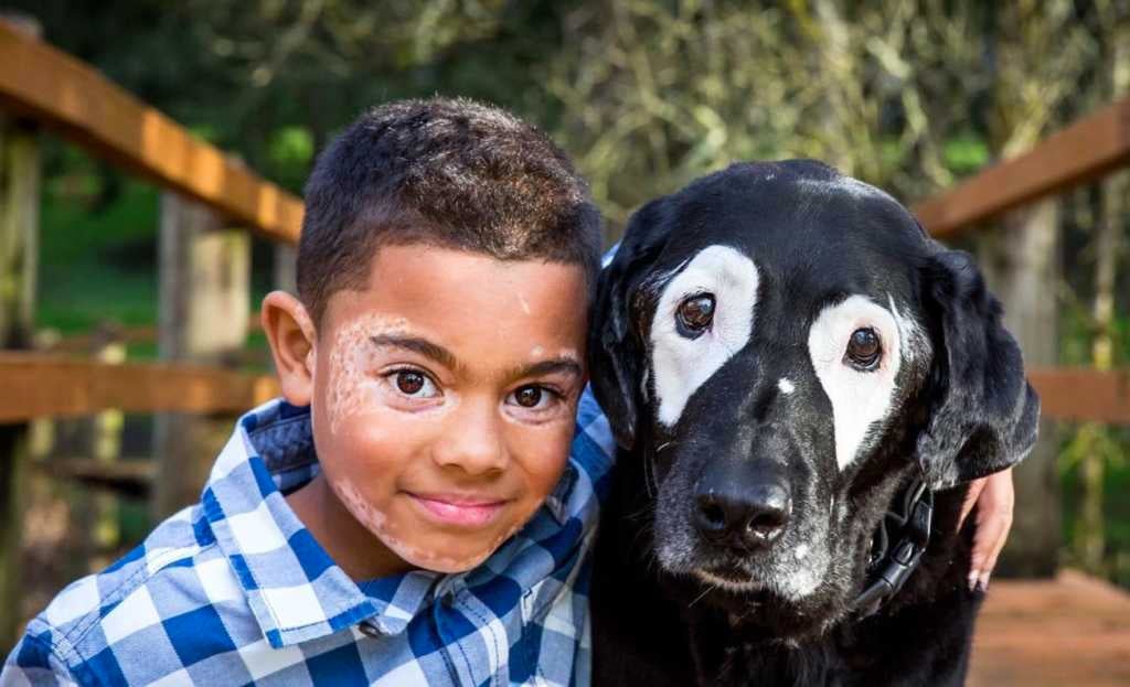 Unique Dog Helps 8-Year-Old Boy with Rare Skin Disorder Who ‘Hated’ His ...