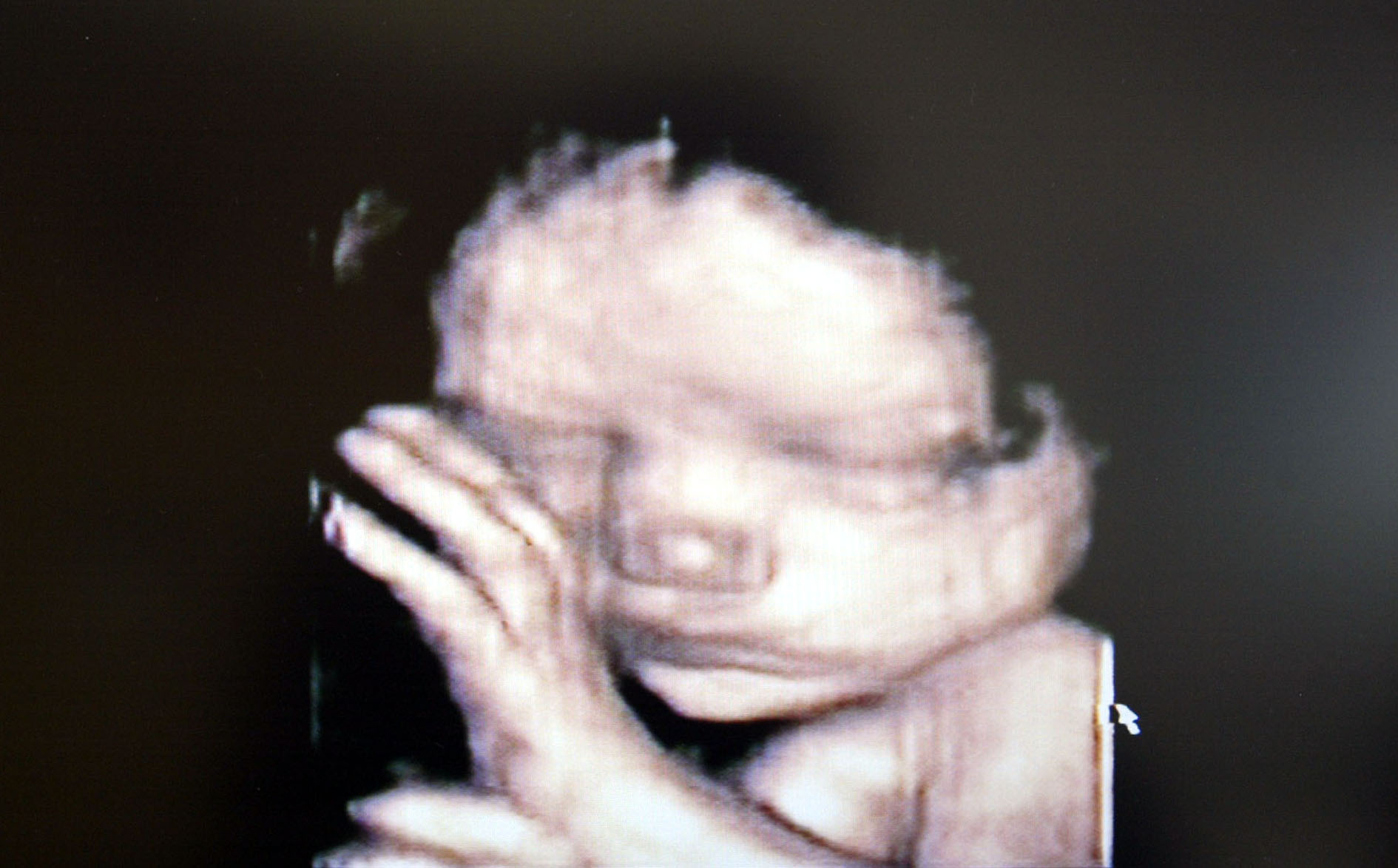 New Research by ProAbortion Scientist Shows Unborn Babies Feel Pain As
