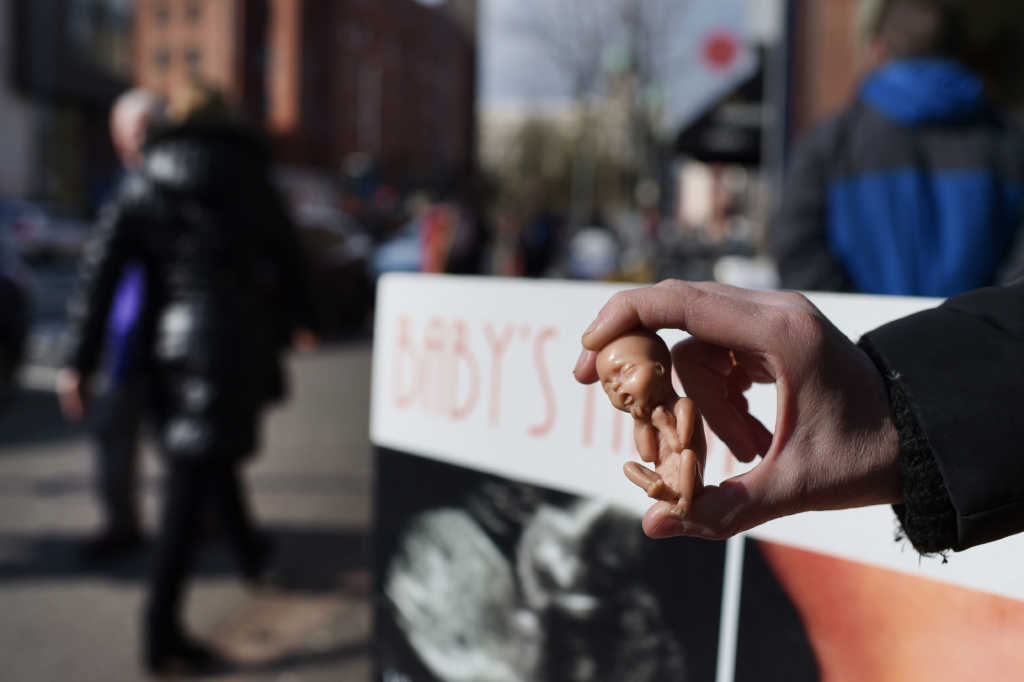 Photo by Charles McQuillan/Getty Images